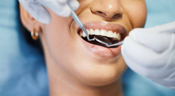 Best Emergency Dentist for Lost Fillings or Crowns in Jay, OK
